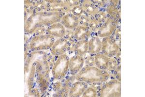Immunohistochemistry of paraffin-embedded mouse kidney using C antibody (ABIN6127549, ABIN6137937, ABIN6137938 and ABIN6223226) at dilution of 1:100 (40x lens). (CARD10 antibody  (AA 863-1032))