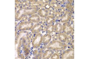 Immunohistochemistry of paraffin-embedded mouse kidney using C antibody (ABIN6127549, ABIN6137937, ABIN6137938 and ABIN6223226) at dilution of 1:100 (40x lens). (CARD10 antibody  (AA 863-1032))