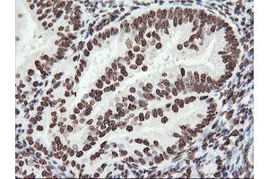 Image no. 3 for anti-F-Box Protein 21 (FBXO21) antibody (ABIN1498233) (FBXO21 antibody)