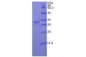 SDS-PAGE analysis of Human RIG1 Protein. (DDX58 Protein)