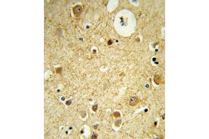 Formalin-fixed and paraffin-embedded human brain tissue reacted with RECK Antibody (Center), which was peroxidase-conjugated to the secondary antibody, followed by DAB staining. (RECK antibody  (AA 430-456))