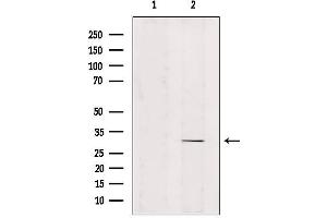 Western blot analysis of extracts from mouse brain, using ZNF498 Antibody. (Zinc Finger and SCAN Domain Containing 25 (ZSCAN25) antibody)