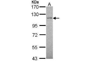 Retinoblastoma Binding Protein 8 antibody  (Center)