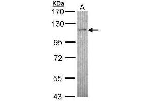 WB Image Sample (30 ug of whole cell lysate) A: Hep G2 , 7. (Retinoblastoma Binding Protein 8 antibody  (Center))