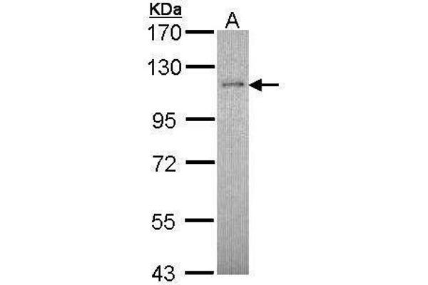 Retinoblastoma Binding Protein 8 antibody  (Center)