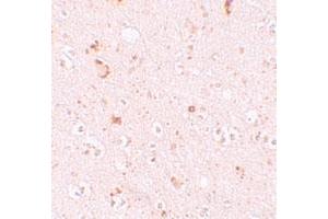Immunohistochemical staining of human brain cells with SH3RF2 polyclonal antibody  at 10 ug/mL. (SH3RF2 antibody  (C-Term))