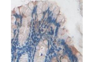 IHC-P analysis of Mouse Tissue, with DAB staining. (ITPA antibody  (AA 2-198))