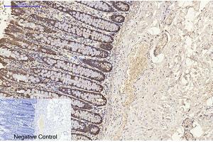 Immunohistochemical analysis of paraffin-embedded human colon tissue. (KRT8 antibody)