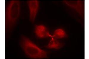 Image no. 2 for anti-Spleen tyrosine Kinase (SYK) (AA 321-325) antibody (ABIN319415) (SYK antibody  (AA 321-325))