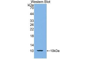 Detection of Recombinant CALY, Human using Polyclonal Antibody to Calcyon Neuron Specific Vesicular Protein (CALY) (CALY antibody  (AA 1-63))