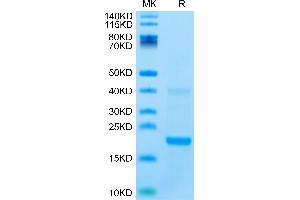 Biotinylated Mouse IL-22 on Tris-Bis PAGE under reduced condition. (IL-22 Protein (AA 34-179) (His-Avi Tag,Biotin))