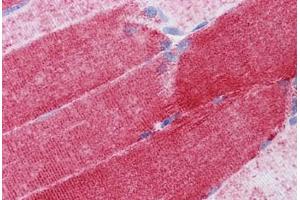 Human Skeletal muscle: Formalin-Fixed, Paraffin-Embedded (FFPE) (COX6B1 antibody  (AA 1-87))