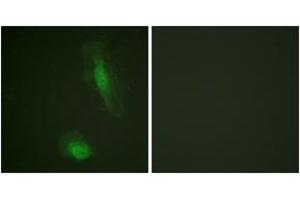 Immunofluorescence analysis of HeLa cells, using Akt (Ab-129) Antibody.