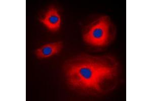 Immunofluorescent analysis of MRPL11 staining in A431 cells.