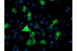 Anti-PFKP mouse monoclonal antibody (ABIN2455341) immunofluorescent staining of COS7 cells transiently transfected by pCMV6-ENTRY PFKP (RC200673). (PFKP antibody)