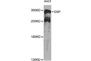 Western blot analysis of extracts of A431 cells, using DSP antibody (ABIN6291454) at 1:1000 dilution. (Desmoplakin antibody)