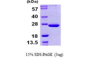 SDS-PAGE (SDS) image for Proteasome (Prosome, Macropain) Subunit, beta Type, 9 (Large Multifunctional Peptidase 2) (PSMB9) (AA 21-219) protein (His tag) (ABIN667409) (PSMB9 Protein (AA 21-219) (His tag))