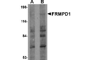 Western Blotting (WB) image for anti-FERM and PDZ Domain Containing 1 (FRMPD1) (C-Term) antibody (ABIN1030403) (FRMPD1 antibody  (C-Term))