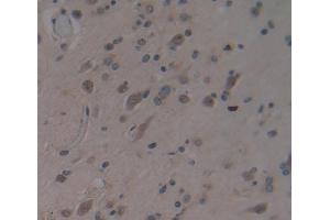 #VALUE! (MYT1 antibody  (AA 905-1127))