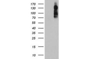 HEK293T cells were transfected with the pCMV6-ENTRY control (Left lane) or pCMV6-ENTRY ENPEP (Right lane) cDNA for 48 hrs and lysed. (ENPEP antibody)