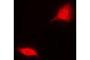 Immunofluorescent analysis of Aspartoacylase staining in MCF7 cells. (ASPA antibody)