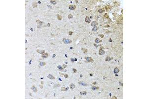 Immunohistochemistry of paraffin-embedded mouse brain using BRCA1 antibody. (BRCA1 antibody  (AA 120-220))