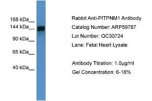 WB Suggested Anti-PITPNM1  Antibody Titration: 0. (PITPNM1 antibody  (N-Term))