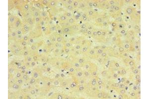 Immunohistochemistry of paraffin-embedded human liver tissue using ABIN7149253 at dilution of 1:100 (CYP2J2 antibody  (AA 328-502))