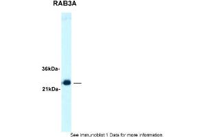 Sample Type: Human brainSecondary Antibody: TIgG product, 1. (RAB3A antibody  (C-Term))