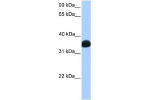 LDHB antibody used at 1 ug/ml to detect target protein.