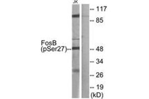 Western Blotting (WB) image for anti-FBJ Murine Osteosarcoma Viral Oncogene Homolog B (FOSB) (AA 12-61), (pSer27) antibody (ABIN482211) (FOSB antibody  (pSer27))
