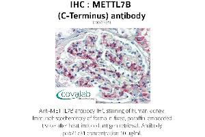 Image no. 2 for anti-Methyltransferase Like 7B (METTL7B) (C-Term) antibody (ABIN1736925)