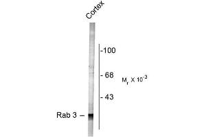 Image no. 1 for anti-RAB3A, Member RAS Oncogene Family (RAB3A) (N-Term) antibody (ABIN372708)
