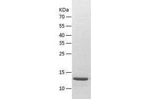 Western Blotting (WB) image for ATP synthase subunit delta, mitochondrial (ATP5F1D) (AA 23-168) protein (His tag) (ABIN7285911) (ATP5F1D Protein (AA 23-168) (His tag))