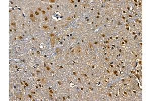 ABIN6260189 and ABIN6268682 at 1/100 staining Rat brain tissue by IHC-P. (BAG1 antibody  (N-Term))