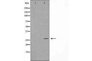 Western blot analysis of extracts from Jurkat cells, using HXA5 antibody.