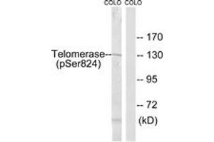 Western blot analysis of extracts from COLO205 cells, using Telomerase (Phospho-Ser824) Antibody. (TERT antibody  (pSer824))