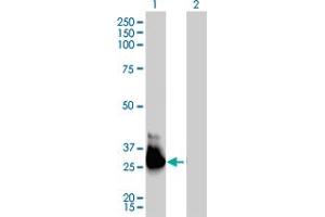 Western Blot analysis of GNA13 expression in transfected 293T cell line by GNA13 monoclonal antibody (M01), clone 6F6-B5. (GNA13 antibody  (AA 1-377))