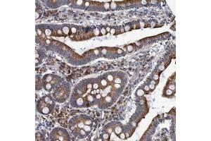 Immunohistochemical staining of human duodenum with NAT16 polyclonal antibody  shows cytoplasmic positivity in glandular cells. (NAT16 antibody)
