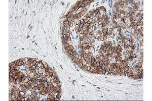 Image no. 8 for anti-Synaptosomal-Associated Protein, 25kDa (SNAP25) antibody (ABIN1501017)