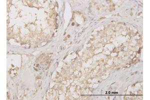 Immunoperoxidase of monoclonal antibody to CTSD on formalin-fixed paraffin-embedded human testis. (Cathepsin D antibody  (AA 26-412))