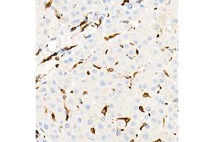 Immunohistochemistry of paraffin-embedded Human liver using CD74 antibody (ABIN7267759) at dilution of 1:100 (40x lens). (CD74 antibody)