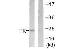 Western blot analysis of extracts from COLO205 cells, using TK (Ab-13) antibody. (TK1 antibody  (Ser13))