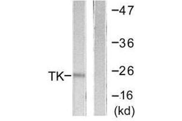 TK1 抗体  (Ser13)