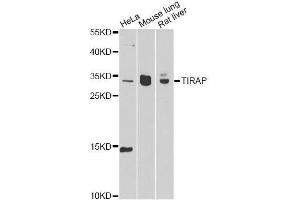 Western blot analysis of extracts of various cell lines, using TIRAP antibody. (TIRAP antibody  (AA 1-221))