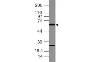Image no. 1 for anti-delta Like Protein 3 (DLL3) (AA 62-286) antibody (ABIN5027148) (DLL3 antibody  (AA 62-286))