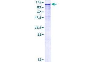 DPP8 Protein (AA 1-898) (GST tag)