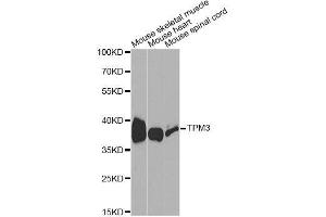 Western Blotting (WB) image for anti-Tropomyosin 3 (TPM3) (AA 1-284) antibody (ABIN3021721)