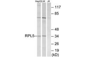 Western blot analysis of extracts from Jurkat/HepG2 cells, using RPL5 Antibody. (RPL5 antibody  (AA 161-210))