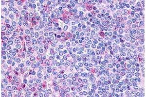 Immunohistochemical staining of human spleen, lymphocytes with P2RY10 polyclonal antibody . (P2RY10 antibody  (Extracellular Domain))